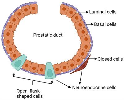 Endocrine and paracrine characteristics of neuroendocrine prostate cancer